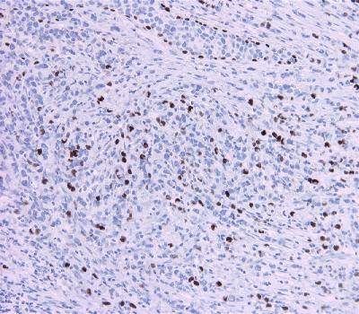 Rabbit Monoclonal Antibody to P63(Clone :BSR6)