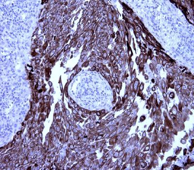 Mouse Monoclonal Antibody to CK5 (CK-HMW)(Clone :BS42)(Discontinued)