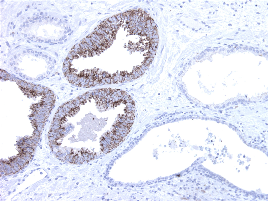 Mouse Monoclonal Antibody to AMACR(Clone :BS2)