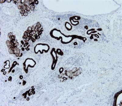 Mouse Monoclonal Antibody to CK19(Clone :BS23)