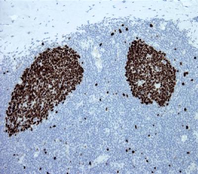 Mouse Monoclonal Antibody to Ki67(Clone :BS4)