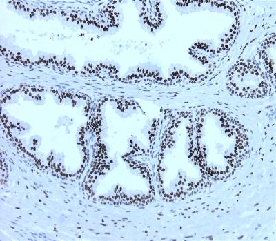 Mouse Monoclonal Antibody to Androgen receptor (Clone :BS46)