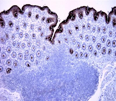 Mouse Monoclonal Antibody to CEA(Clone :BS33)(Discontinued)