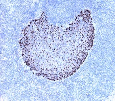 Mouse Monoclonal Antibody to p63a(Clone :BS63)(Discontinued)