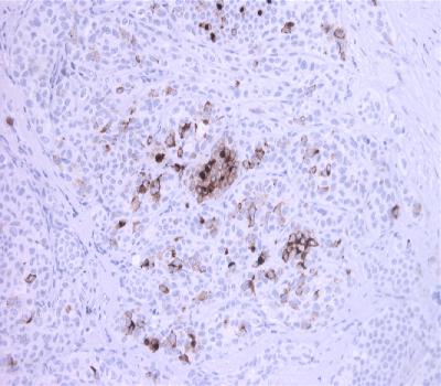 Mouse Monoclonal Antibody to Mammaglobin(Clone :BS17)