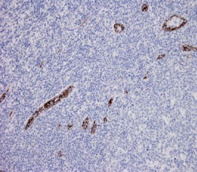 Mouse Monoclonal Antibody to Endoglin (CD105)(Clone :BS71)