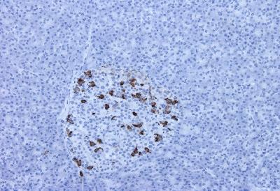 Mouse Monoclonal Antibody to Somatostatin(Clone :BS16)