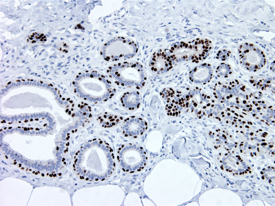 Mouse Monoclonal Antibody to SOX10(Clone :BS7)