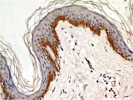 NALE™ Monoclonal Antibody to TLR4 (Clone: ABM19C4)