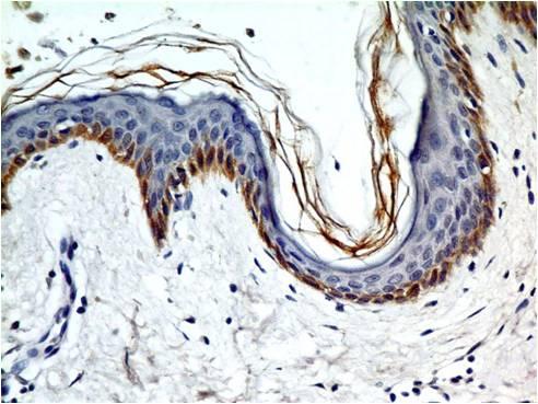 Monoclonal Antibody to TLR5 (Clone: ABM22G1)