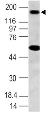 Monoclonal Antibody to NALP3 (Clone: ABM2D48)