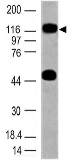 Monoclonal Antibody to TLR10 (Clone: ABM3C85)