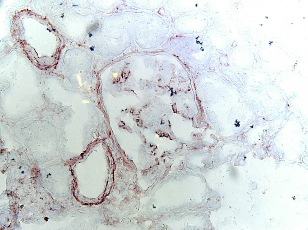 Monoclonal Antibody to Human/Mouse TLR2 (Clone : TL2.3)(Discontinued)