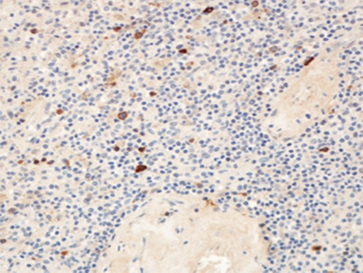 Monoclonal Antibody to Human CD180 (Clone-MHR73)(Discontinued)