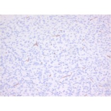 Monoclonal Antibody to mouse CD34(Discontinued)