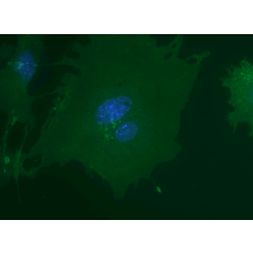 Monoclonal Antibody to mouse VCAM-1(Discontinued)