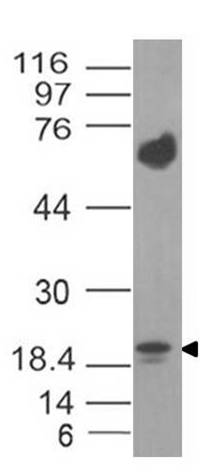 Monoclonal Antibody to IL-17F (Clone: ABM2H17)