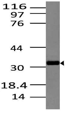 Monoclonal Antibody to Dectin-2 (Clone: ABM2H28)