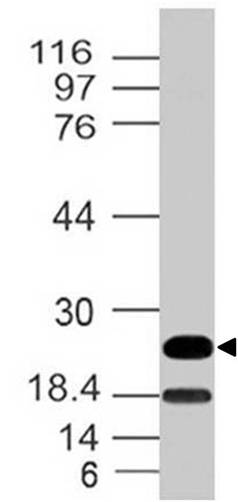 Monoclonal Antibody to Mouse EBI3 (Clone: ABM2C40)