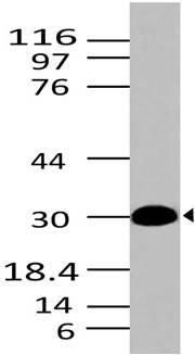 Monoclonal Antibody to HMGB1 (Clone: ABM24C2)