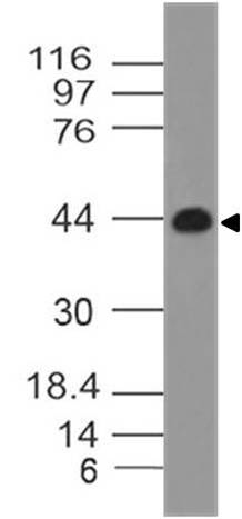 Monoclonal Antibody to IL-3RA (Clone: ABM25C1)