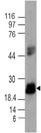 Monoclonal Antibody to IL-17C (Clone: ABM2H52)