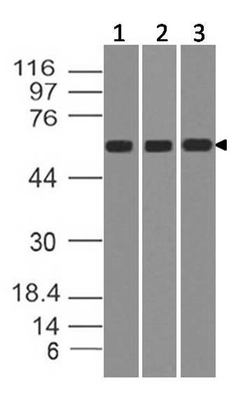 Monoclonal Antibody to IL-23R (Clone: ABM25G4)