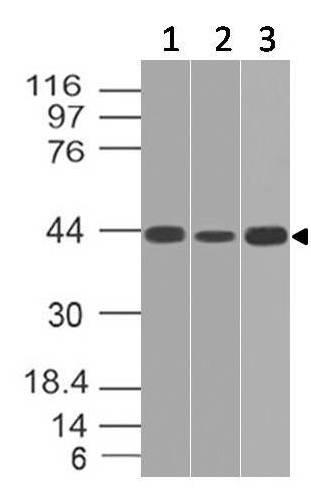 Monoclonal Antibody to IL-17RE (Clone: ABM2G70)