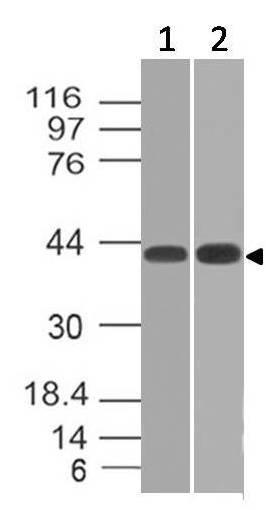 Monoclonal Antibody to TSLP Receptor (Clone: ABM2D87)