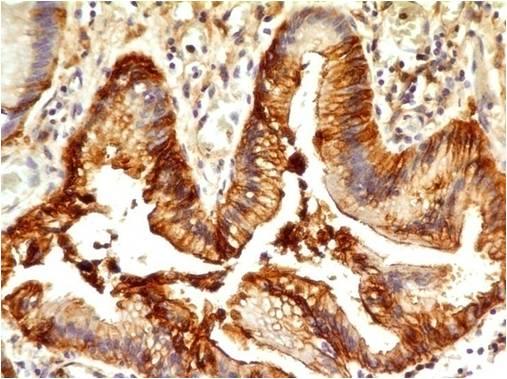 Monoclonal Antibody to CD33(Clone: ABM29D3)