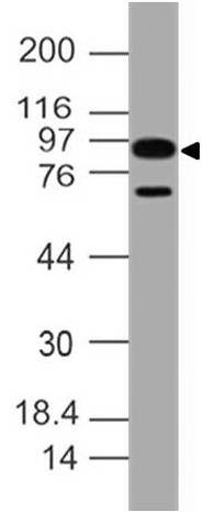 Monoclonal Antibody to Human IL-17 RA (Clone: ABM4A10)