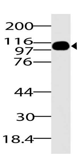 Monoclonal Antibody to RIG-I (Clone: ABM40B5)