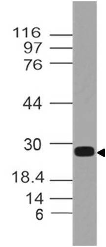 Monoclonal Antibody to Human EBI3 (Clone:  ABM40H9)