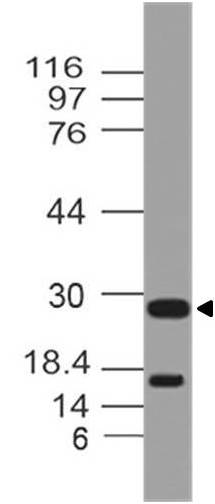 Monoclonal Antibody to hTSLPR (Clone: ABM3B96)