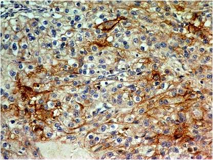 Monoclonal Antibody to CD73 (Clone: ABM40E2)