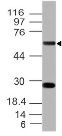 Monoclonal Antibody to Human CD39 (Clone:  ABM41E2)