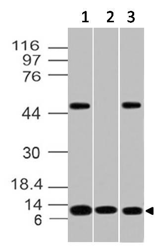 Monoclonal Antibody to S100A8, human (Clone: ABM41E4)