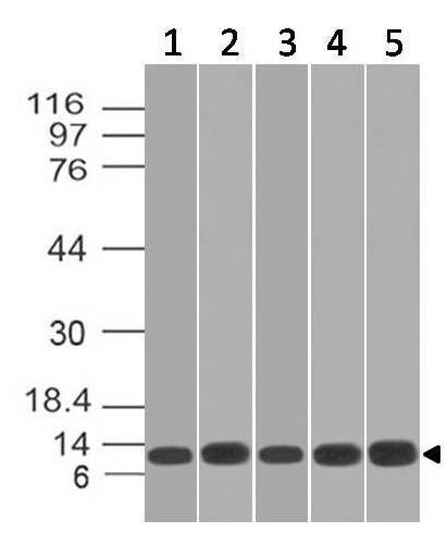 Monoclonal Antibody to S100A8, human (Clone: ABM4G30)