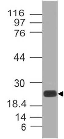 Monoclonal Antibody to CLEC4E (Clone: ABM42C6)