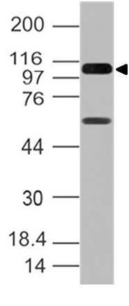 Monoclonal Antibody to RIG-I (Clone: ABM4H29)