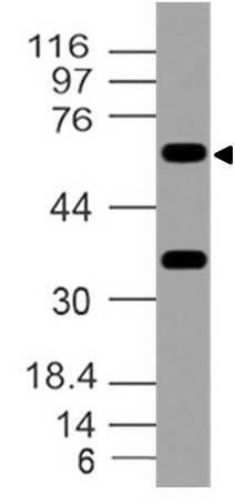 Monoclonal Antibody to FOXO1 (Clone: ABM4E66)