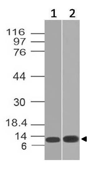 Monoclonal Antibody to Mouse S100A8 (Clone: ABM4A69)