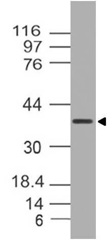 Monoclonal Antibody to MUL1 (Clone: ABM4F71)