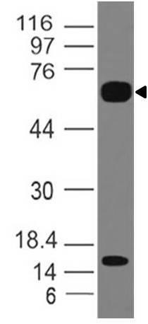 Monoclonal Antibody to IL-36R (Clone: ABM47A2)