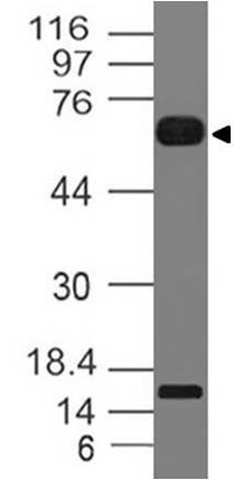 Monoclonal Antibody to IL-36R (Clone: ABM4B73)