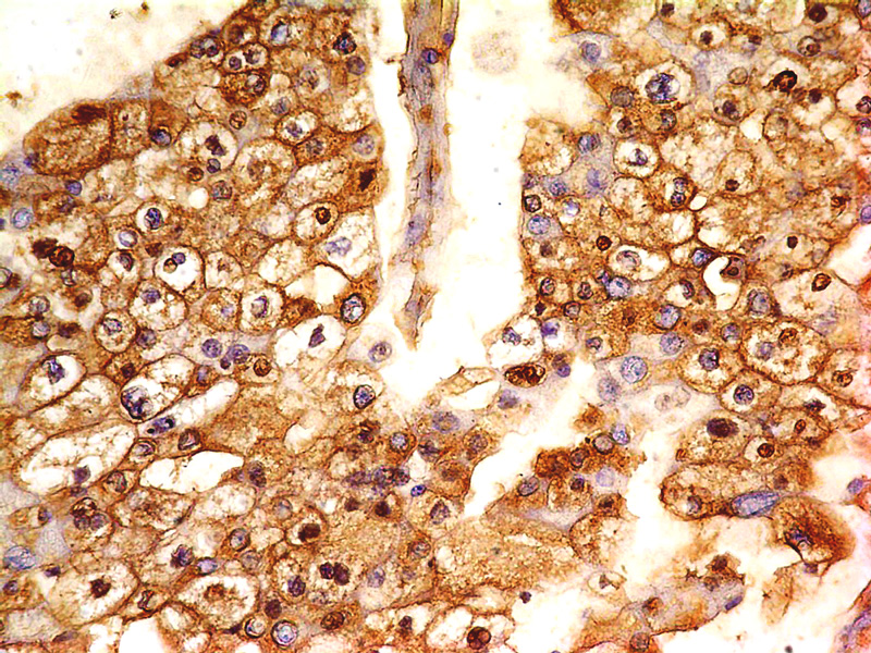 Monoclonal antibody to B7-H4 (Clone: ABM53A6)