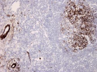 Monoclonal Antibody to human C9 neoepitope (Clone: aE11)