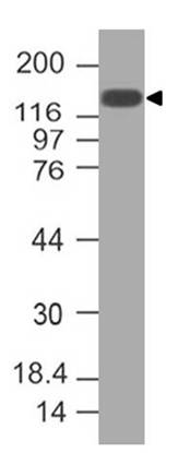 Monoclonal antibody to CD163 (Clone: ABM5A68)