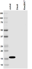 Monoclonal antibody to CD247/CD3 Zeta (TCR Zeta, CD3 Zeta) (Clone: 6B10.2)