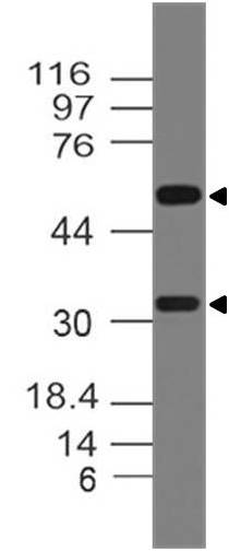 Monoclonal Antibody to RANKL (Clone: ABM10A7)